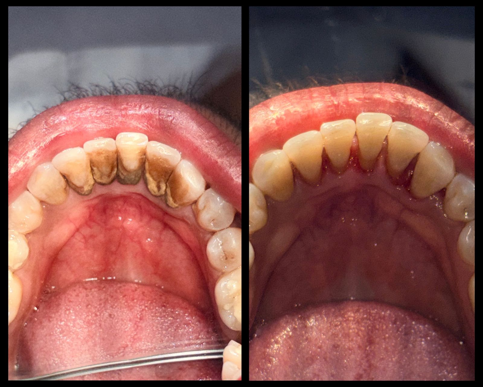 Clinical before and after transformation 1