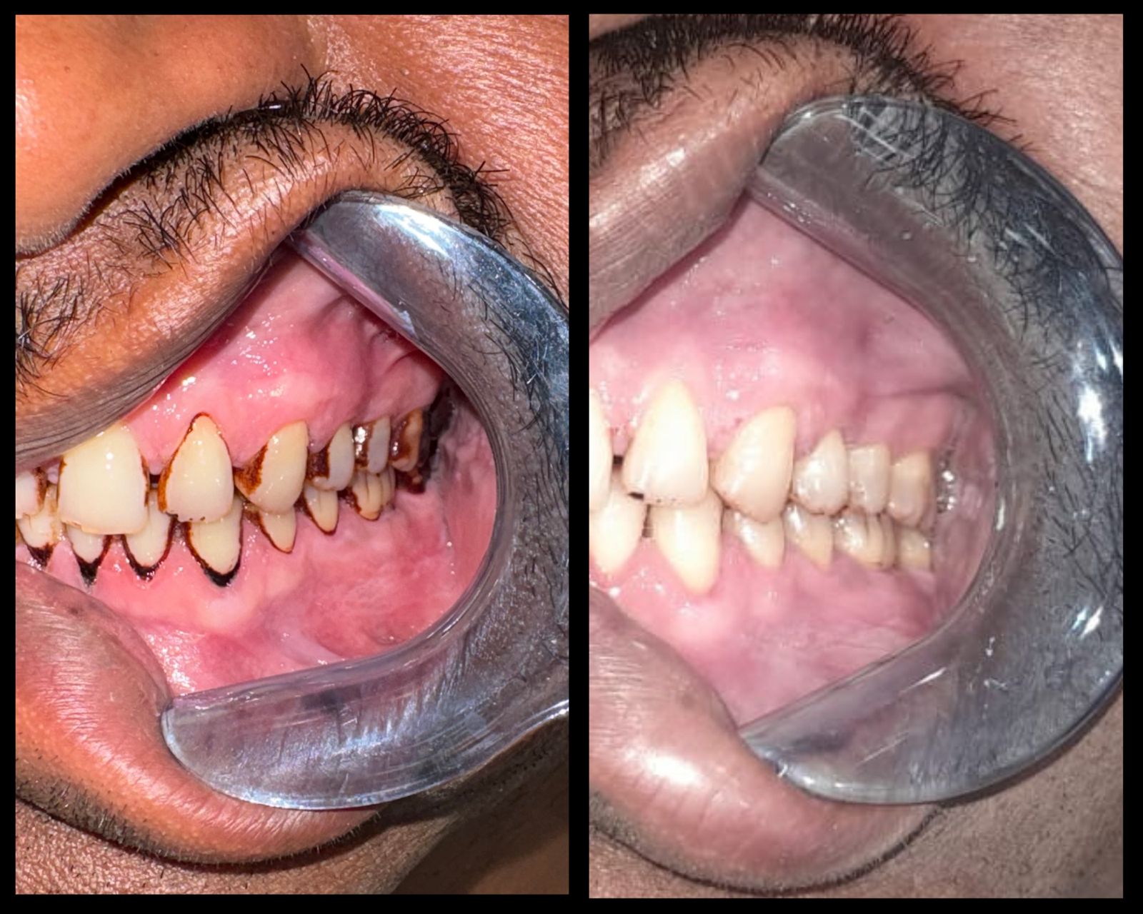 Clinical before and after transformation 2