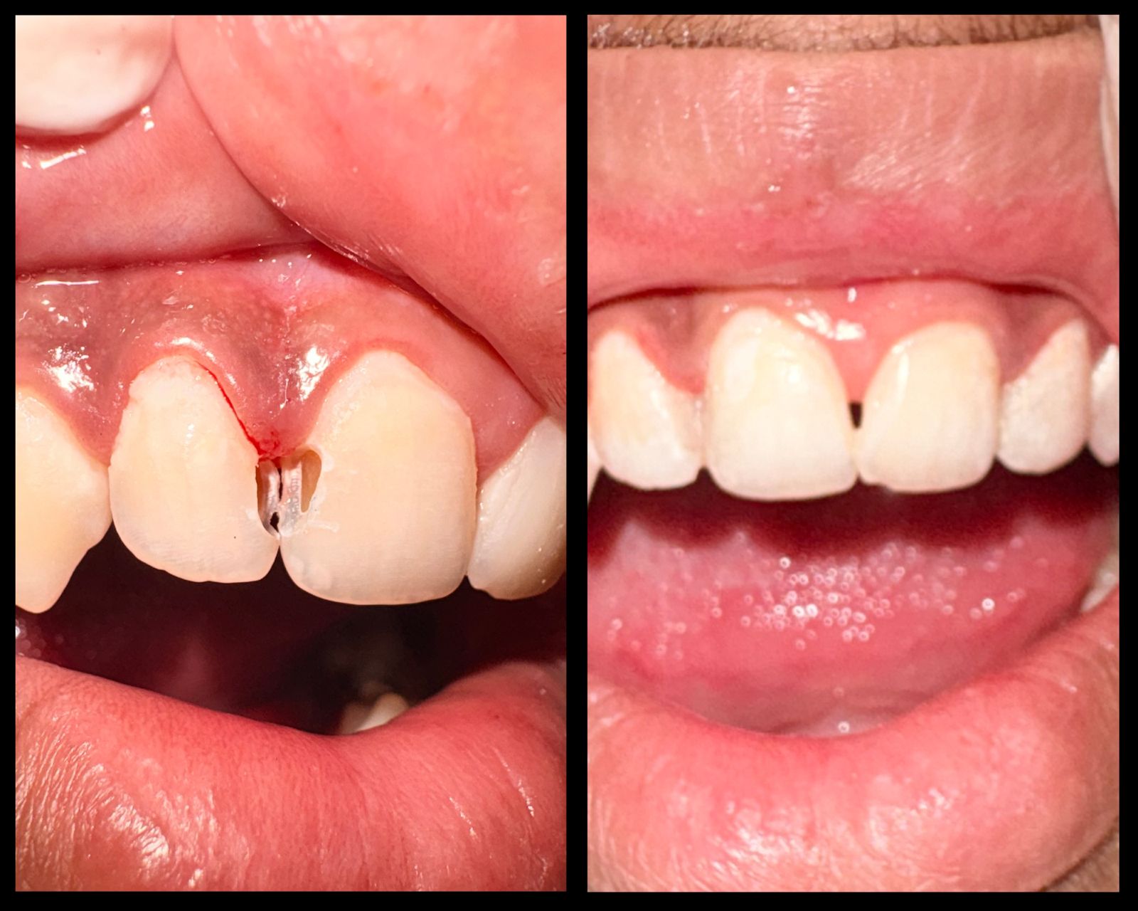 Clinical before and after transformation 3